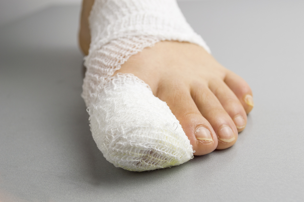 Toe Nail Surgery Chiropody Clinics